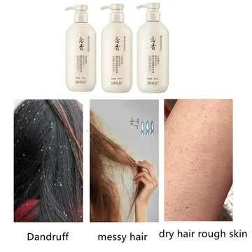 ClearRoots Anti-Dandruff Shampoo - Hair Regrowth & Thickening Treatment for Men & Women